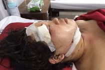 Chồng đánh vợ nhập viện rồi treo cổ chết tại nhà