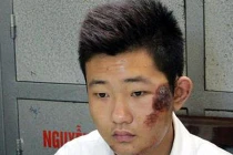 Bảo vệ Cát Tường “thấy bình thường” sau khi giúp bác sĩ vứt xác