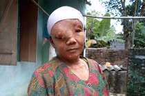 Người đàn bà “mặt quỷ“ ở xứ Thanh