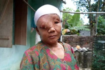 Người đàn bà “mặt quỷ“ ở xứ Thanh