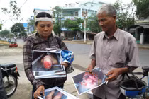 Bộ mặt thật chốn công quyền trong vụ 5 công an dùng nhục hình