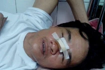 Công an bị tố bắn người trọng thương: Bộ Công an vào cuộc