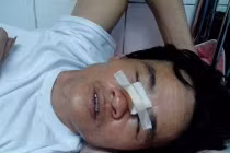 Công an bị tố bắn người trọng thương: Bộ Công an vào cuộc