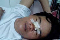 Dân tố bị công an bắn vào đầu: Trưởng CA huyện phủ nhận