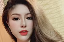 MXH Việt dậy sóng với màn lột xác của gái trẻ sau thẩm mỹ