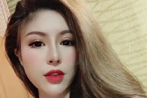 MXH Việt dậy sóng với màn lột xác của gái trẻ sau thẩm mỹ