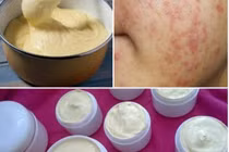 Mách bạn cách nhận biết kem trộn có chứa corticoid nguy hại da 