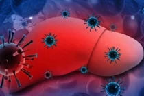 5 triệu chứng lặp đi lặp lại chứng tỏ gan đang tích tụ quá nhiều độc tố