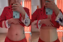 Bí kíp lấy lại eo thon sau sinh của Hải Băng khiến bác sĩ kinh hãi 