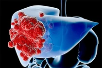 Cả đời không lo ung thư gan khi dành 1 phút làm điều này