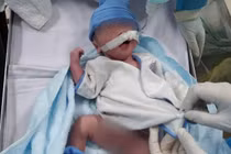 Bé trai chào đời tại phòng sinh dã chiến khi mẹ nguy kịch vì COVID-19