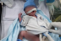 Bé trai chào đời tại phòng sinh dã chiến khi mẹ nguy kịch vì COVID-19