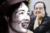 Qua miêu tả của Nam Cao, Thị Nở xấu xí đến độ nào? 