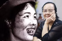 Qua miêu tả của Nam Cao, Thị Nở xấu xí đến độ nào? 