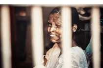 Hồi ức rợn người những cô gái bị tạt axit ở Ấn Độ