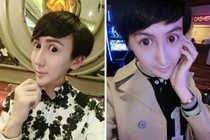 Hết hồn chàng trai giống yêu tinh vì phẫu thuật thẩm mỹ