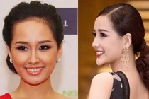 Những chiếc cằm trông vô lý hết sức của sao Việt