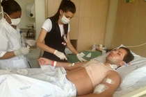 4 ca phẫu thuật thẩm mỹ liều mạng của các búp bê sống