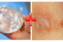 Miếng dán silicon: đẹp vòng 1 và đầy ẩn hoạ chết người