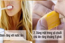 Mẹo hay lấy cao răng bằng vỏ chuối