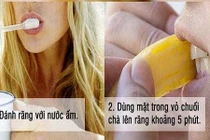 Mẹo hay lấy cao răng bằng vỏ chuối