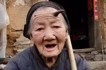 Bí ẩn về những người bị... mọc sừng