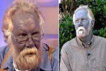 Khám phá bí ẩn về tộc người kì lạ có da màu xanh