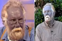 Khám phá bí ẩn về tộc người kì lạ có da màu xanh