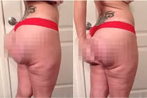 Hãi hùng vòng 3 phẫu thuật thẩm mỹ hỏng