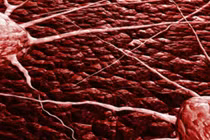 Sự tàn phá khủng khiếp của ung thư cổ tử cung