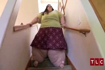 Cô gái như quái vật vì ăn quá nhiều