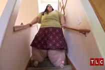 Cô gái như quái vật vì ăn quá nhiều