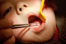 Dây chuyền thánh giá rơi vào họng, bé gái đi cấp cứu