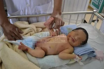 Bé gái bị bỏ rơi ở bụi tre, dòi, kiến bâu đầy người