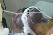 Hình ảnh khủng khiếp về tác hại của món tiết canh