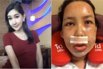 Hot girl chuyển giới khoe ảnh dao kéo gớm ghiếc