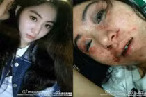 Ca sĩ bị đánh đập dã man vì không chịu hầu rượu