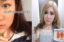 Gái xinh Thái Lan cắt thịt ở má làm cằm V-line