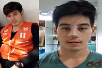 “Hot boy xe ôm” lộ ảnh phẫu thuật thẩm mỹ mũi lệch