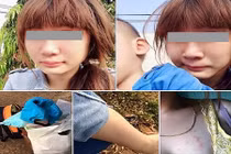 Cô gái lên mạng tố bị nhà chồng đánh hội đồng 