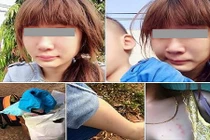 Cô gái lên mạng tố bị nhà chồng đánh hội đồng 