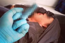 Y tá giơ ngón tay thối vào mặt bệnh nhân hấp hối