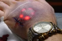 Giới trẻ khoét thịt, cấy đèn LED dưới da rùng rợn