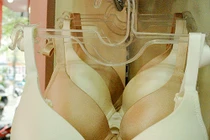 Đau dai dẳng sau 1 năm phẫu thuật ung thư vú