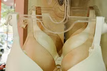 Đau dai dẳng sau 1 năm phẫu thuật ung thư vú