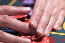 Điểm mặt bệnh nguy hiểm chết người qua móng tay