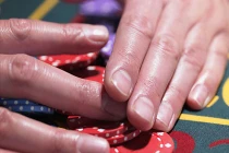 Điểm mặt bệnh nguy hiểm chết người qua móng tay