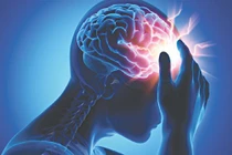 Những người dễ bị đột quỵ não khi trời lạnh