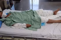 Đang ngồi nhà, vợ bất ngờ bị chồng đánh, đổ xăng thiêu sống