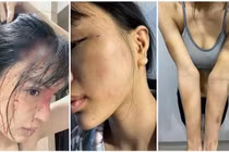 Công an vào cuộc vụ siêu mẫu Khả Trang tố chồng hành hung